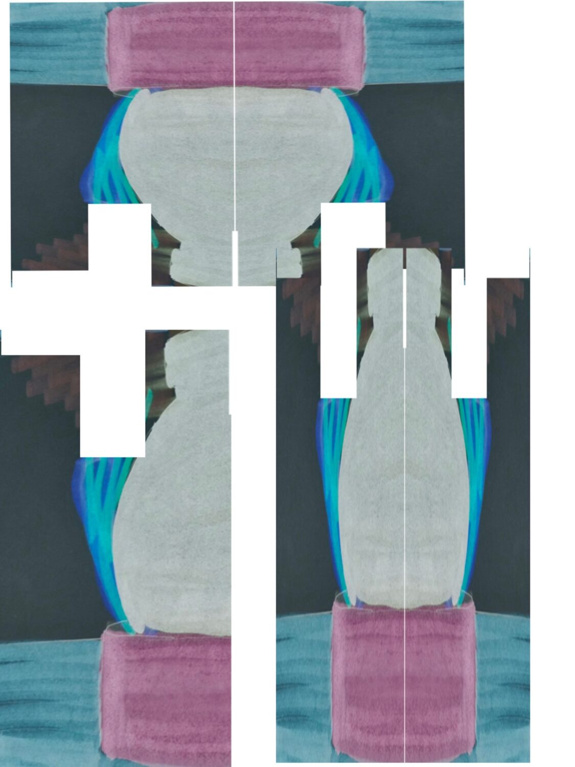 Amongst the Frames: Undoing a way puzzlement, amongst the frames